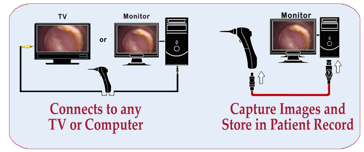 Wired HowItWorks Wired Video Otoscope