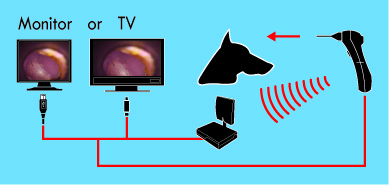 Wiredless digital Video Otoscope