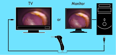 Wired digital Video Otoscope