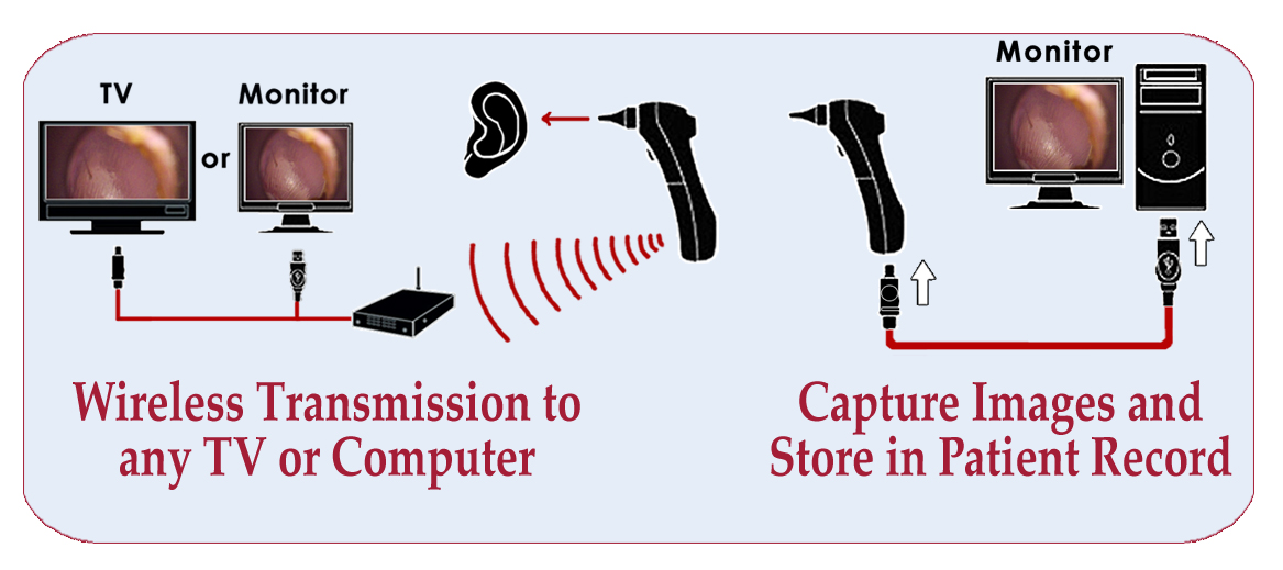 Wired Video Otoscope