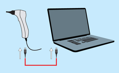 Wireless Video Otoscope for Humans