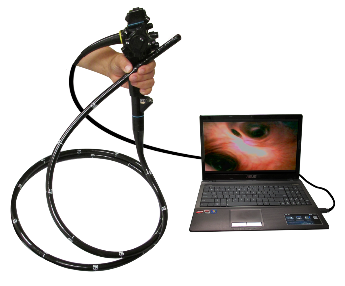 A gastroscope connected to a laptop. Uses the USB port.