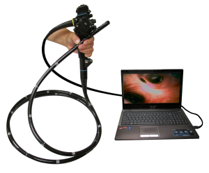 A gastroscope connected to a laptop. Uses the USB port.